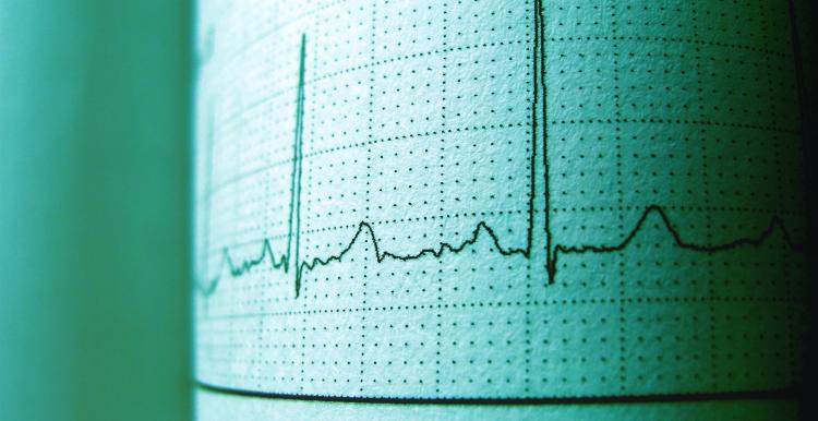 Photo of an ECG printout of a heartbeat